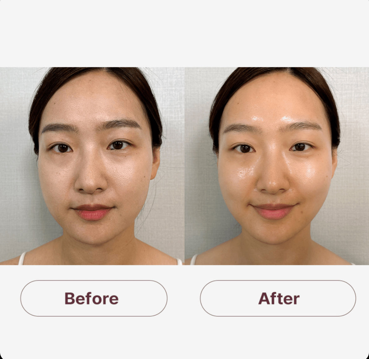 Medisco Skin Glow Mask
